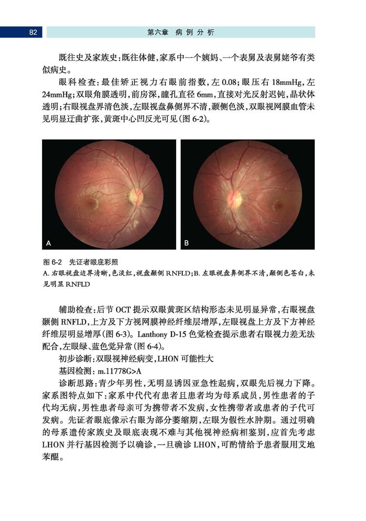 视神经疾病 视神经疾病ppt