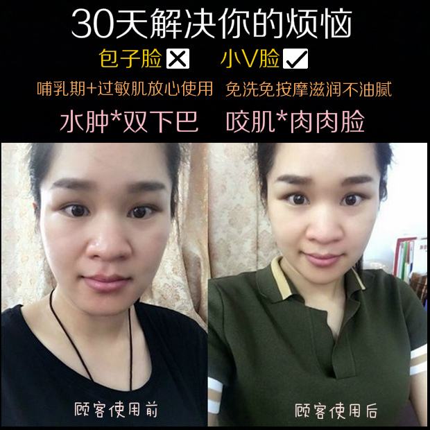 如何消除咬肌 如何消除咬肌瘦脸