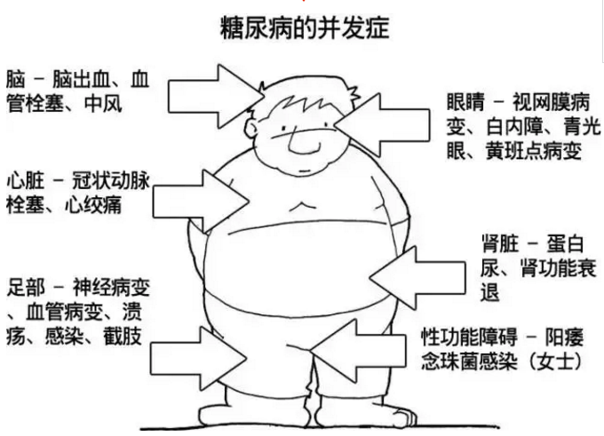 常见疾病有哪些 夏季常见疾病有哪些