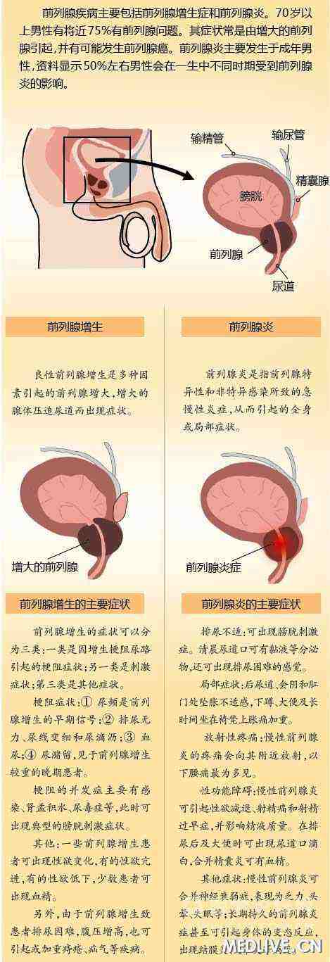 性功能障碍疾病 治疗男性性功能障碍疾病