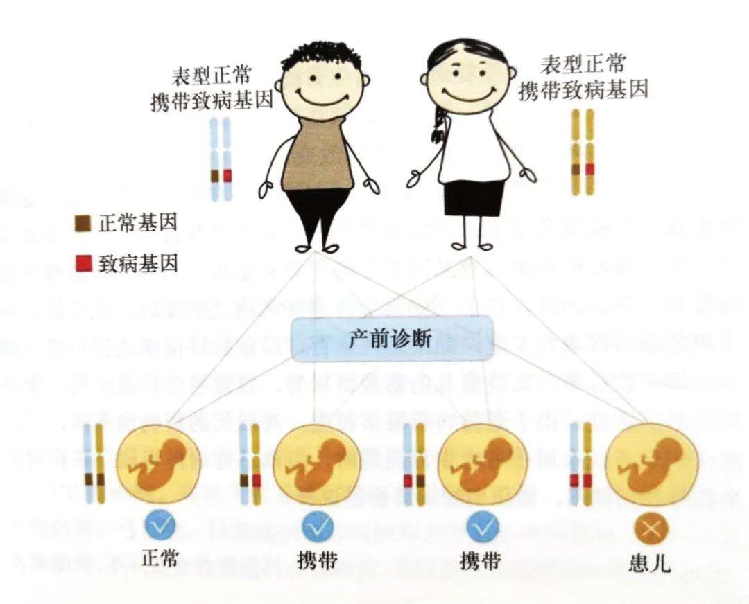 遗传性疾病有哪些 眼睛遗传性疾病有哪些