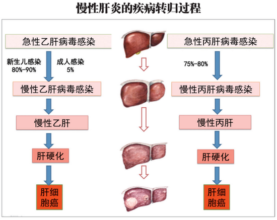 疾病转归 疾病转归怎么写