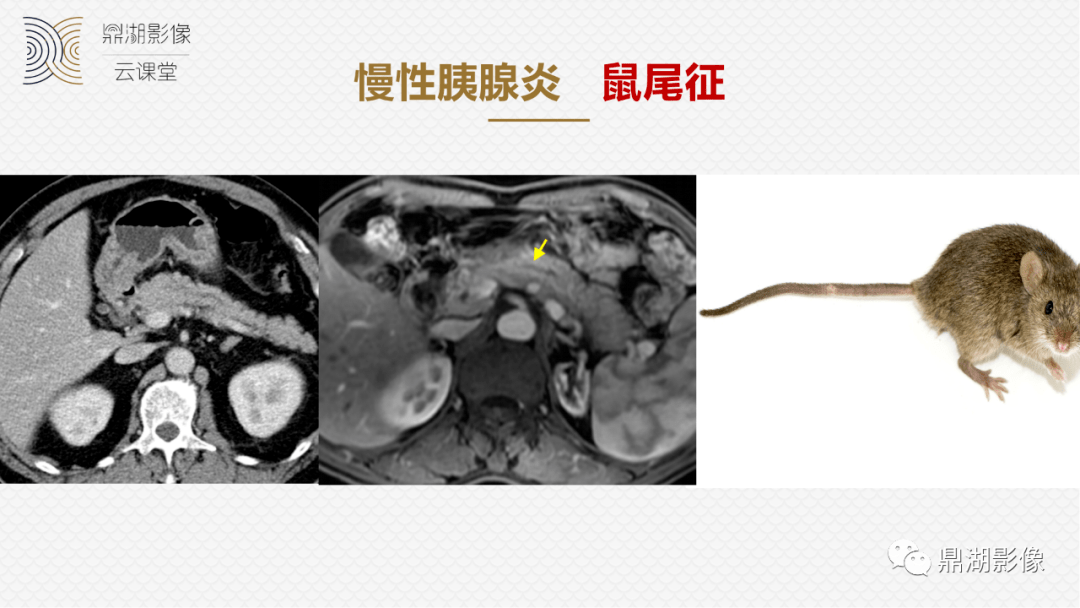 胰腺疾病 胰腺疾病的症状表现有哪些