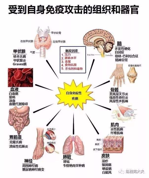 免疫疾病有哪些 全身性免疫疾病有哪些