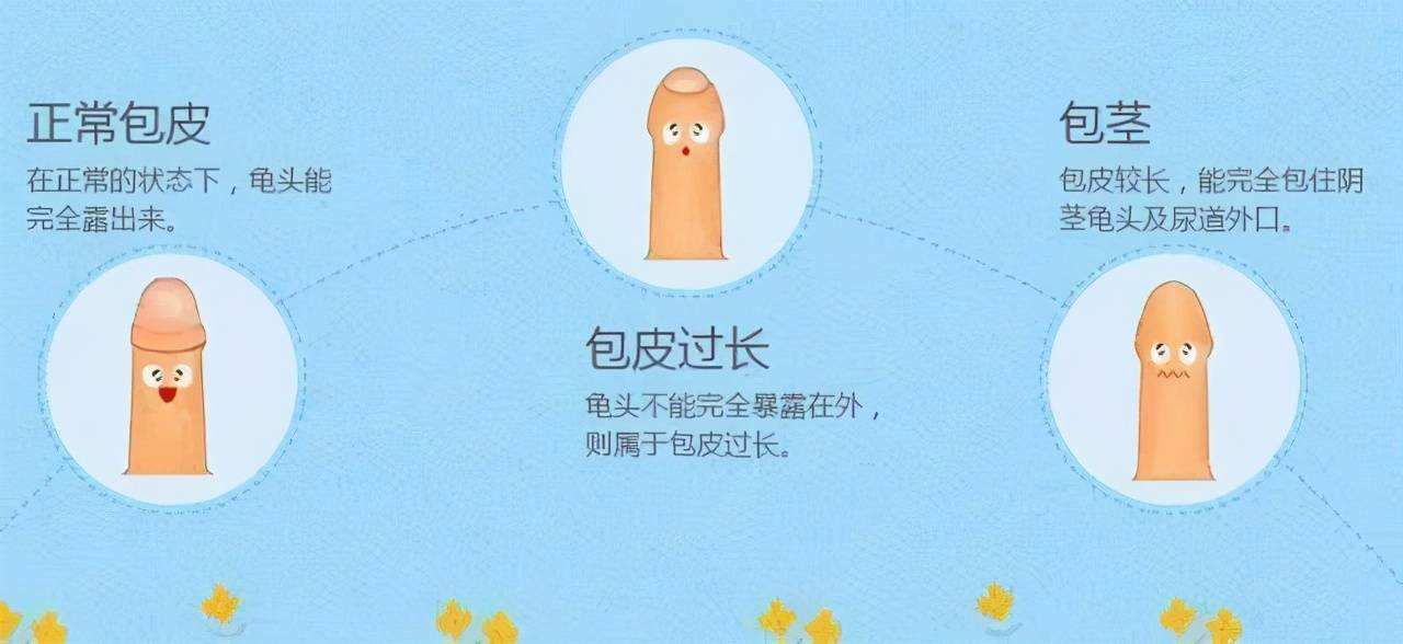 包皮过长有什么影响 男童包皮过长有什么影响