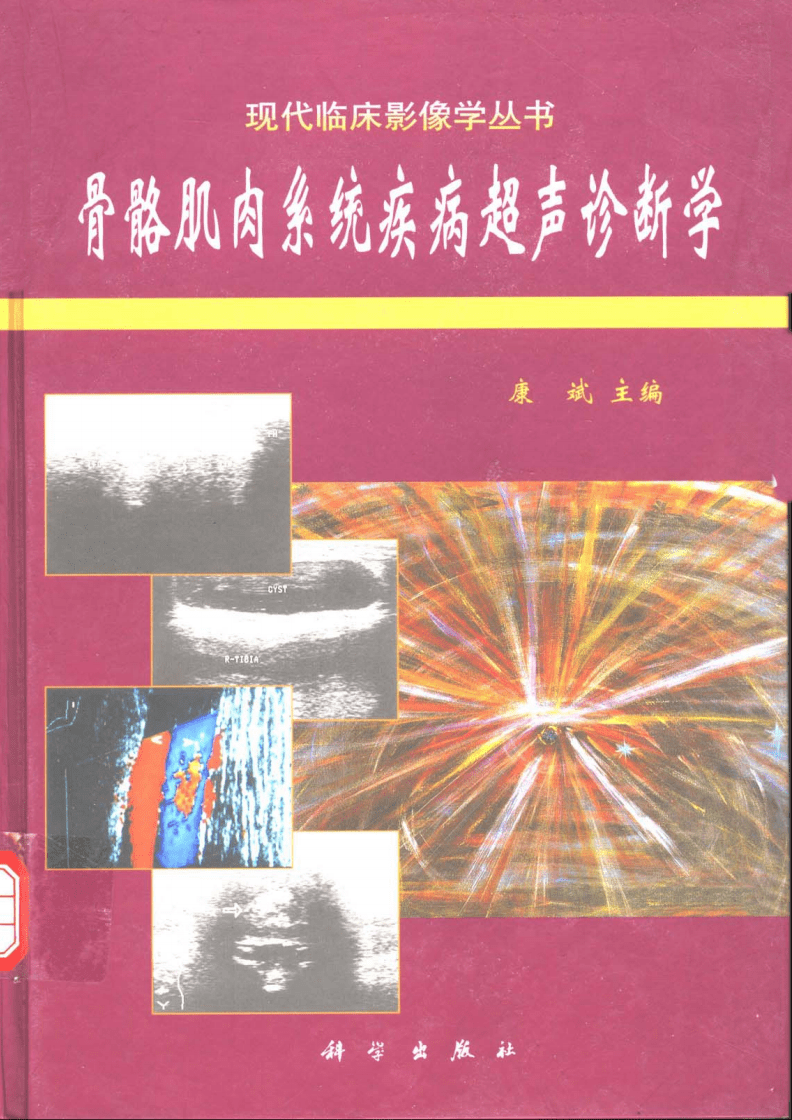 肌肉骨骼疾病 肌肉骨骼疾病常见的功能障碍有哪些