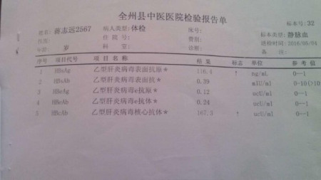 hbsag阴性是什么意思 表面抗原hbsag阴性是什么意思