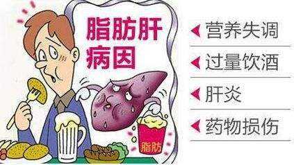 甘油三酯是什么 甘油三酯是什么原因造成的