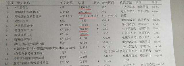 甲胎蛋白偏高说明什么 唐筛甲胎蛋白偏高说明什么