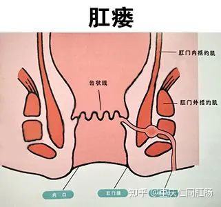 肛门疾病 肛门疾病有哪些症状