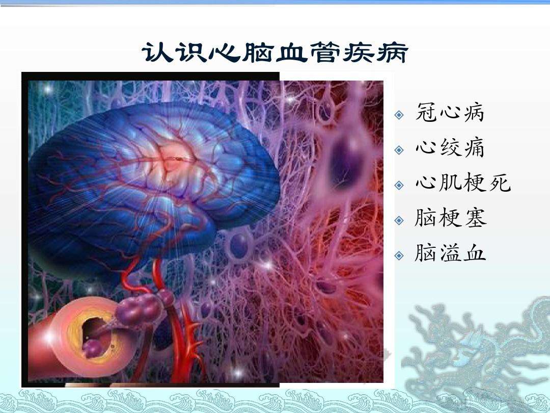 疾病的图片 脑血管疾病的图片