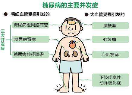 疾病的图片 脑血管疾病的图片