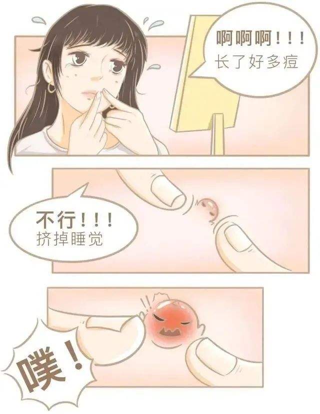 如何挤痘痘 如何挤痘痘不感染