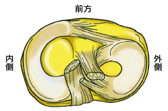 半月板损伤如何治疗 半月板损伤如何治疗?