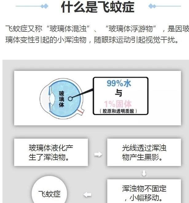 飞蚊症如何治疗 眼睛患飞蚊症如何治疗