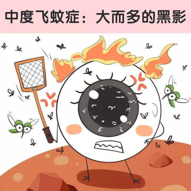 飞蚊症如何治疗 眼睛患飞蚊症如何治疗