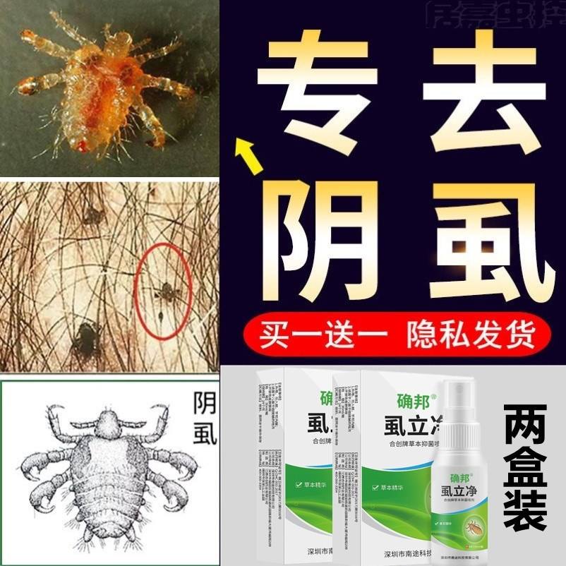 阴虱如何治疗 阴虱如何治疗方法