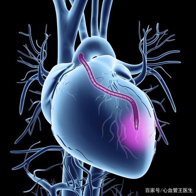 怎样预防心机梗塞 怎样预防心肌梗塞的发生