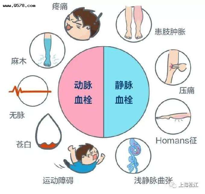 孕妇如何预防血栓 孕妇如何预防血栓形成