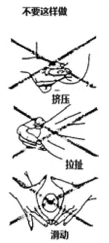 坐月子正确挤奶 月子里产妇挤奶怎么办